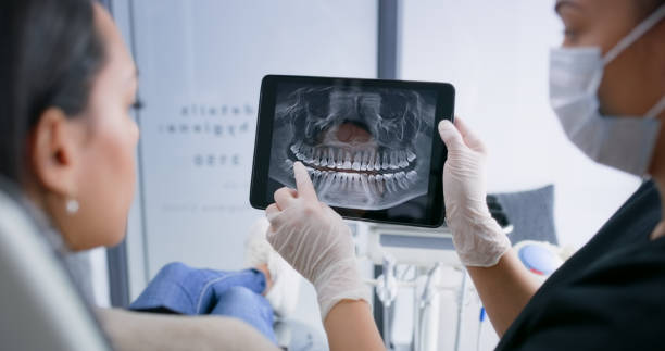 Licensed Tooth Extraction service in Duncanville, TX - Smile Center Dentistry